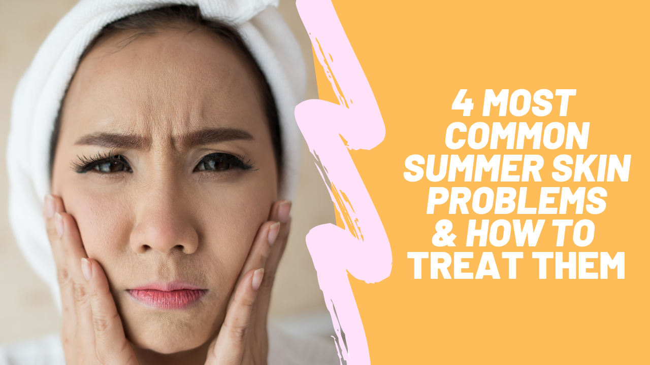 4 Common Summer Skin Problems and How to Treat Them!